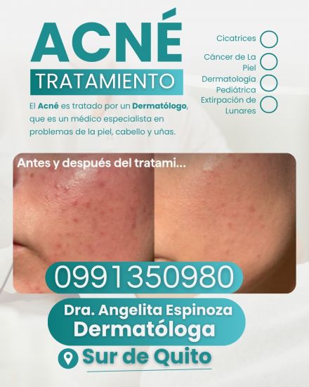 Dermat&oacute;loga al Sur de Quito: Dermat&oacute;logas al Sur de Quito