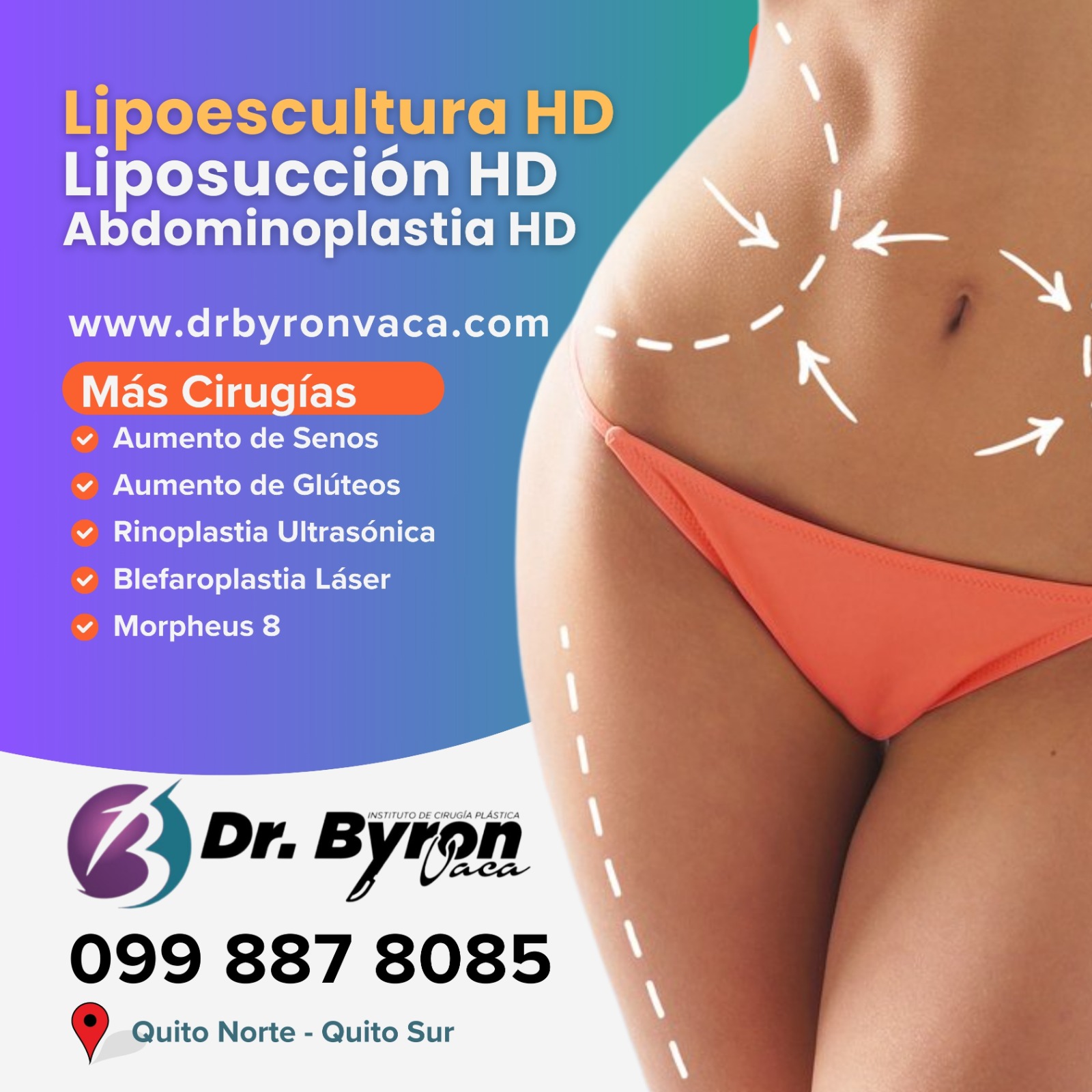 Dr. Byron Vaca: Lipoescultura en Quito -  HD Liposculpture in Quito