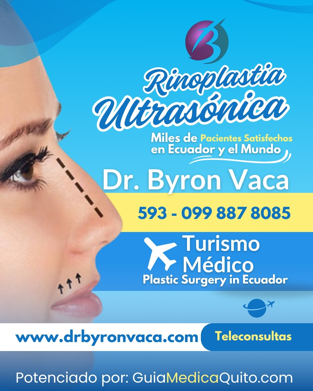 Dr. Byron Vaca: Rinoplastia Ultras&oacute;nica en Quito