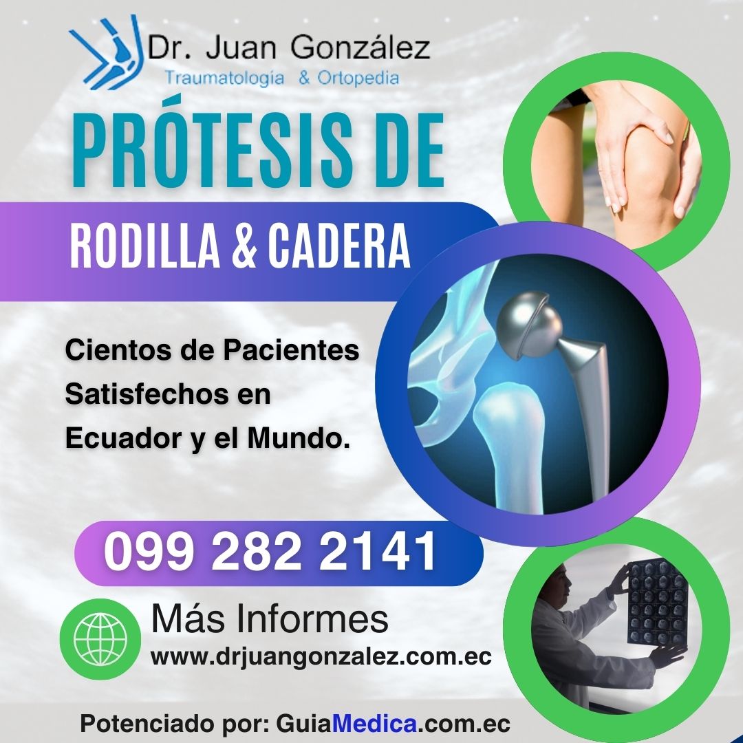 Dr. Juan Gonz&aacute;lez: Traumat&oacute;logo en Quito 